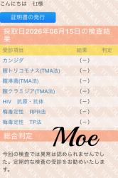 Moe