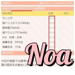 Noa