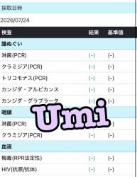 Umi